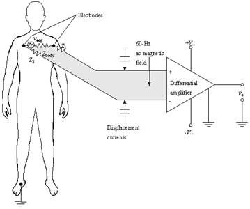 ECG systems